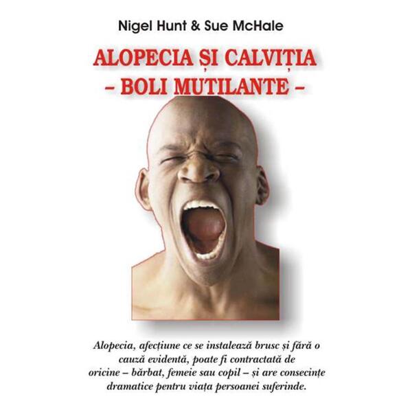 Alopecia şi calviţia - Nigel Hunt, Sue McHale - Antet Revolution