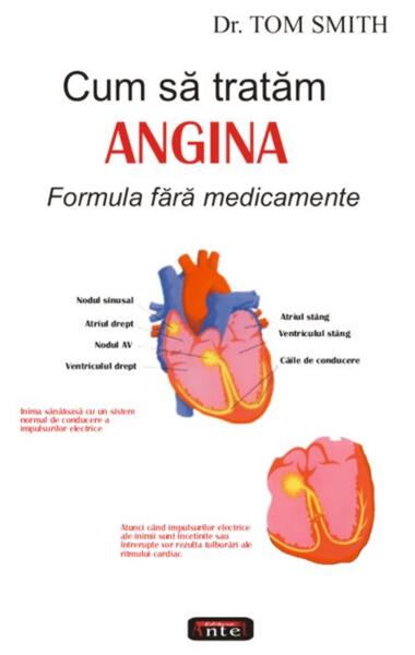 Cum să tratăm angina - Tom Rob  Smith - Antet Revolution