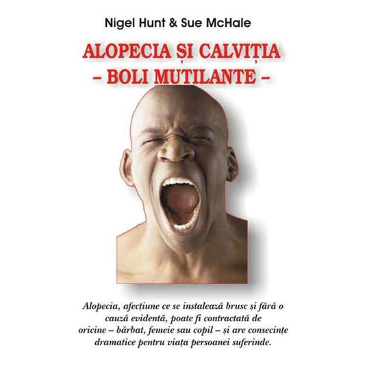 Alopecia şi calviţia - Nigel Hunt, Sue McHale - Antet Revolution