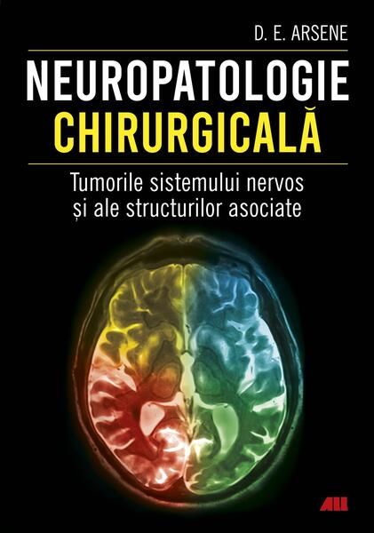 Neuropatologie chirurgicală. Tumorile sistemului nervos și ale structurilor asociate - Dorel Eugen Arsene - All